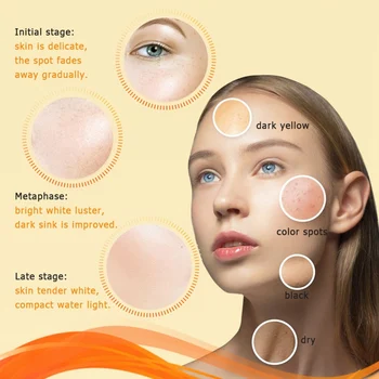25g Facial, Crema de Día Papaya Spot Whitening Face Cream Spots de la Peca Quita la Cara Crema Hidratante Nutritiva