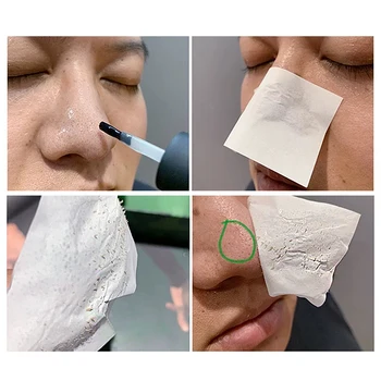 BREYLEE Removedor de la Espinilla del Tratamiento del Acné de Suero disminuye el Poro Esencia Negro de la Máscara de Cuidado de la Piel de la Máscara de la Cara de desprendimiento de la Hoja de la Máscara Facial
